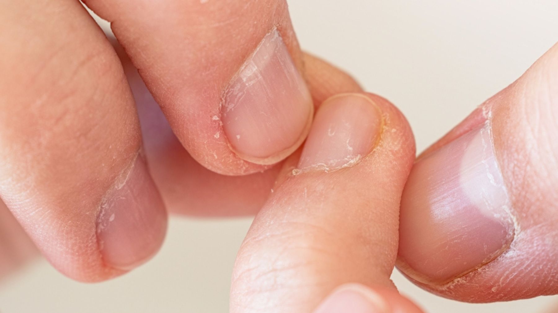 10 signs from your nails that tell about your health condition